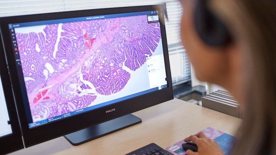 philips and aws collaborate to scale digital pathology in the cloud (1)